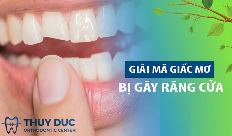 Giải mã giấc mơ gãy răng cửa: Ý nghĩa và điềm báo